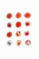 Groupes sanguins - Tests immunologiques mettant en évidence les différents groupes sanguins chez l'Homme